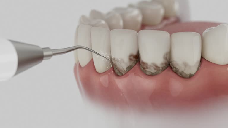 Trusted Tooth Extraction service in Sardis, MS - Dentist Open Now